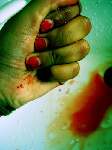 Fotografia de Marco - Galeria Fotografica: Blood - Foto: hazte polvo