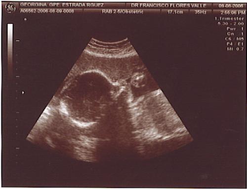 Fotografia de S.R.M. MIA - Galeria Fotografica: B/N - Foto: Alex