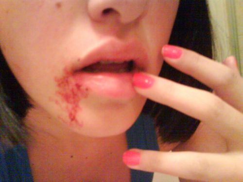 Fotografia de Hard Candy - Galeria Fotografica: Lalala love - Foto: D�jame entrar