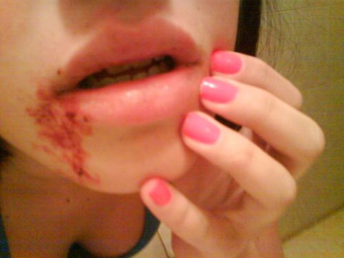 Fotografia de Hard Candy - Galeria Fotografica: Lalala love - Foto: Vampire