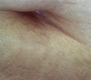 Fotografia de M. Esteras - Galeria Fotografica: Macrofotografia B/N y Color - Foto: 