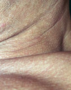 Fotografia de M. Esteras - Galeria Fotografica: Macrofotografia B/N y Color - Foto: 