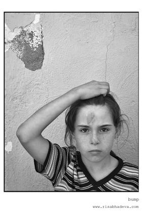 Fotografia de Difference - Galeria Fotografica: Wild Child - Foto: Bump