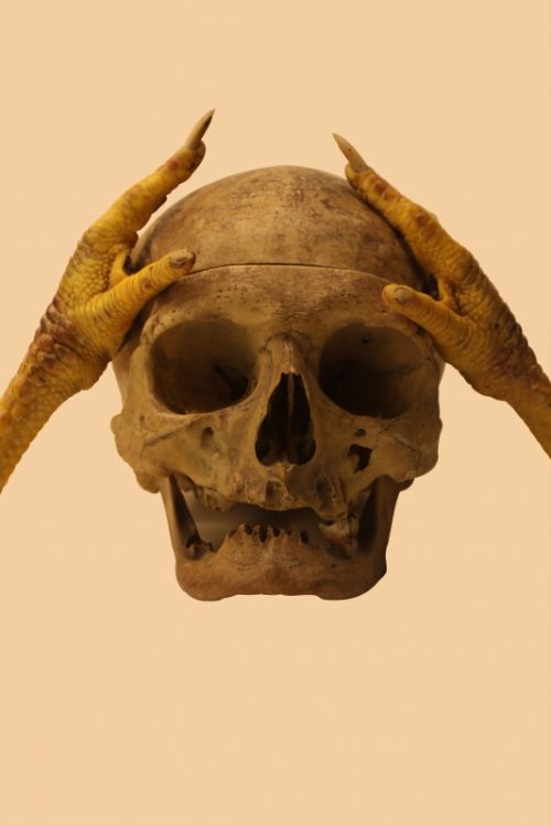 Fotografia de Javier Sanz - Galeria Fotografica: surrealismo - Foto: !Qu dolor de cabeza!