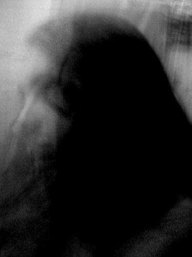 Fotos menos valoradas » Foto de CL BC - Galería: Ana Difusa - Fotografía: Pinate sin tiempo