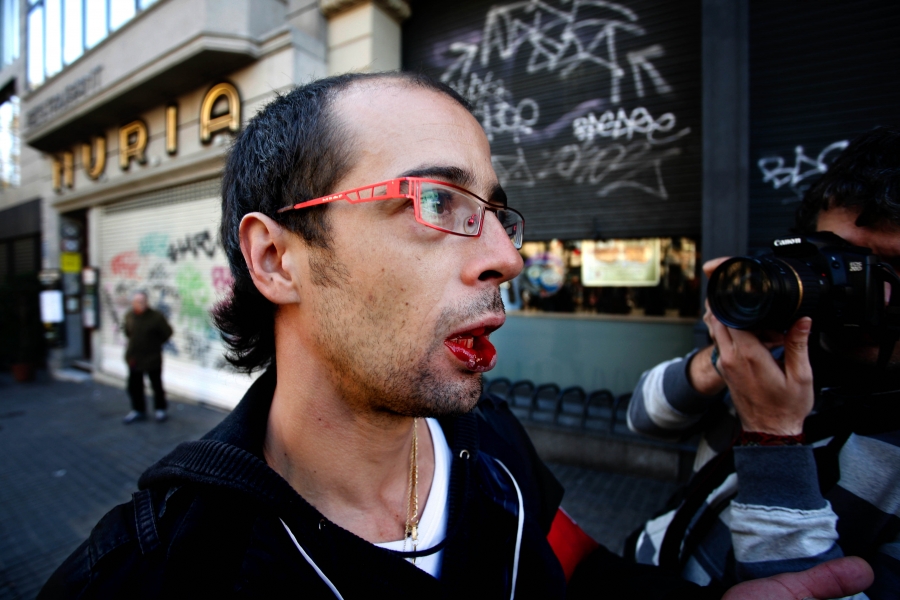Jose Colon con el labio partido el 20 de noviembre